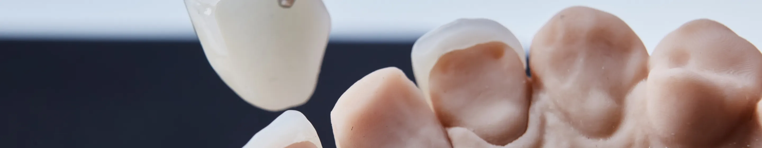 ファーストビュー