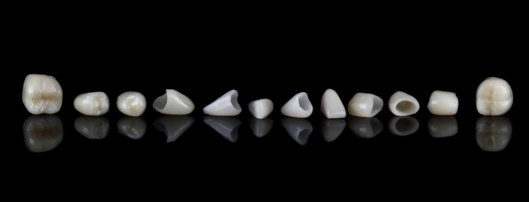 4.天然歯と調和する“セラミック”という選択肢