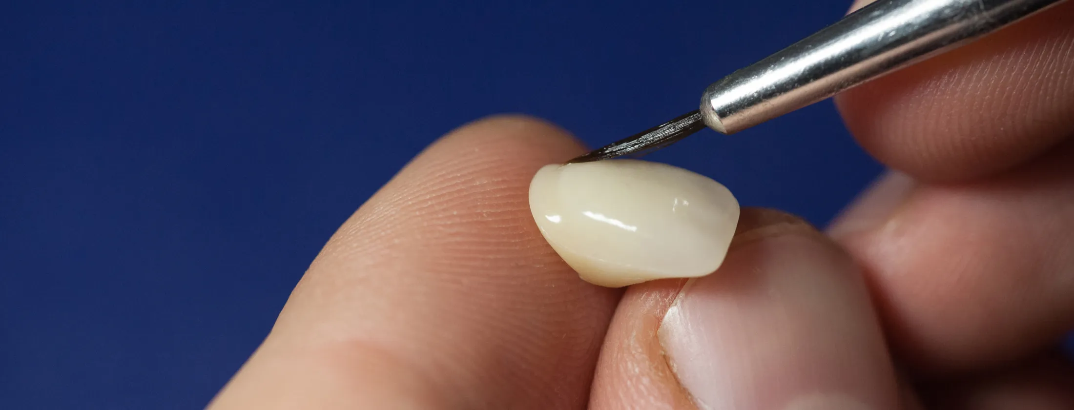 8. セラミック治療の成功は“技工士との連携”で決まる