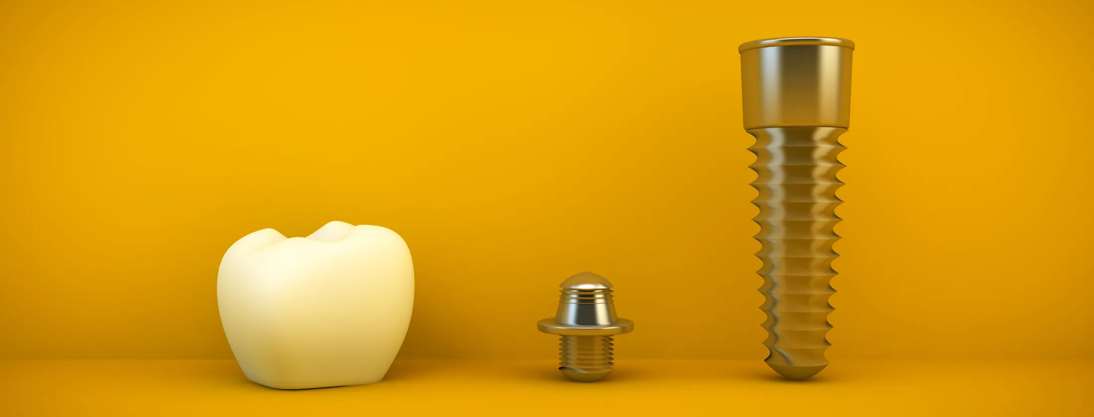 4.LOTUS DENTAL CLINIC東京が自由診療を軸に診療を行う理由