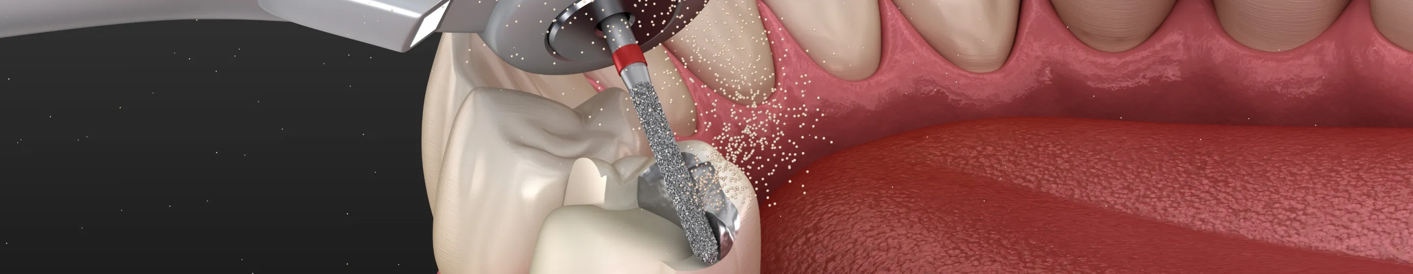 ファーストビュー