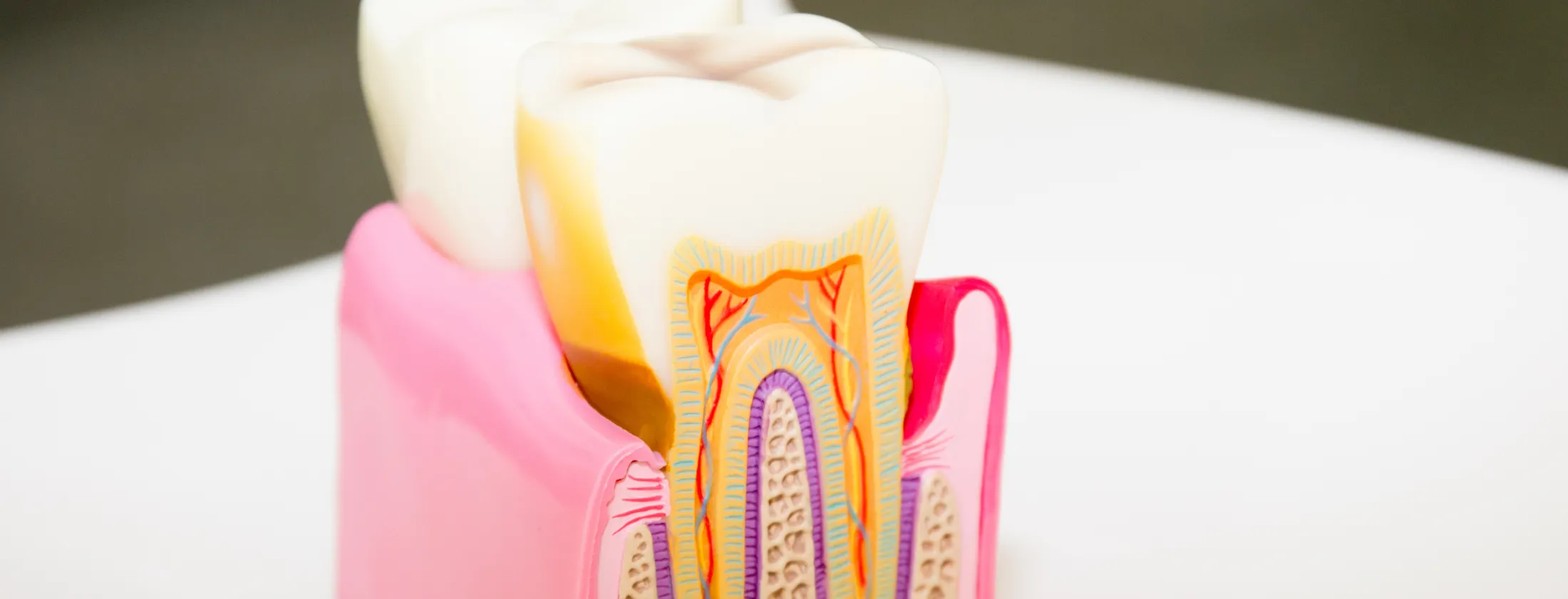 1. 重度虫歯は“まだ治せる”可能性があります