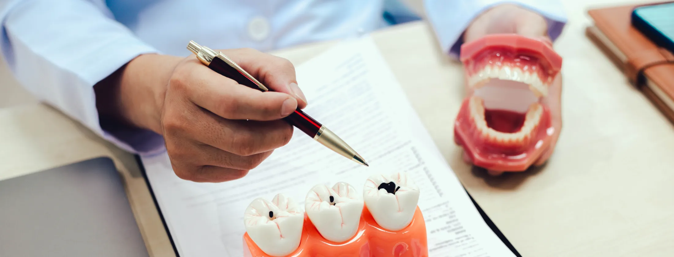 2. 重度虫歯が進行する本当の理由