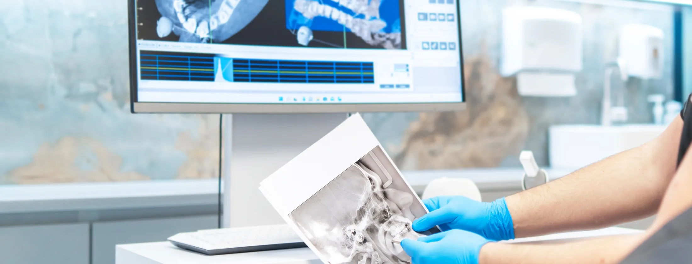 4.重度虫歯をどこまで残せるか見極める“精密診査”