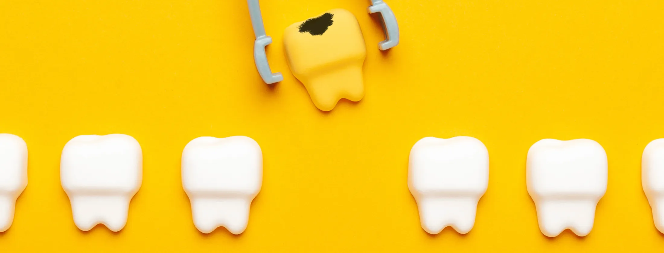 9. 他院で抜歯と診断された方へ