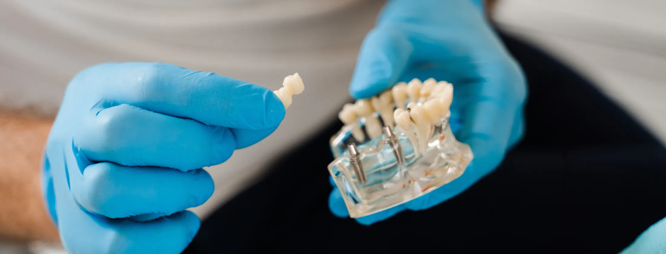 5.インプラント治療の流れ（初診～メンテナンスまで）