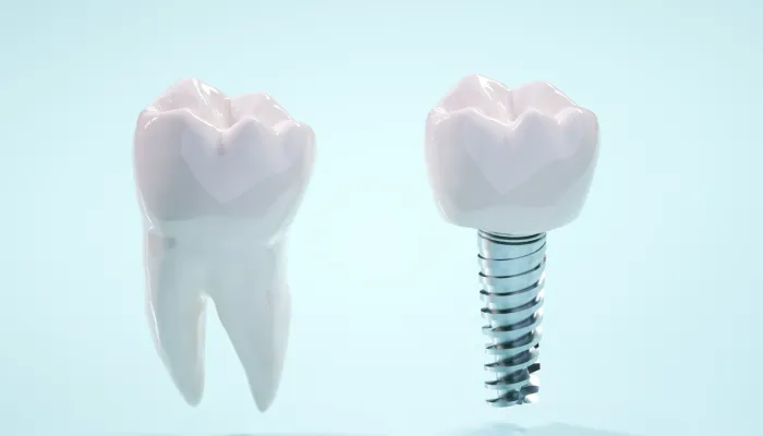 7.骨が少ない方や難症例への対応（骨造成・再生治療など）