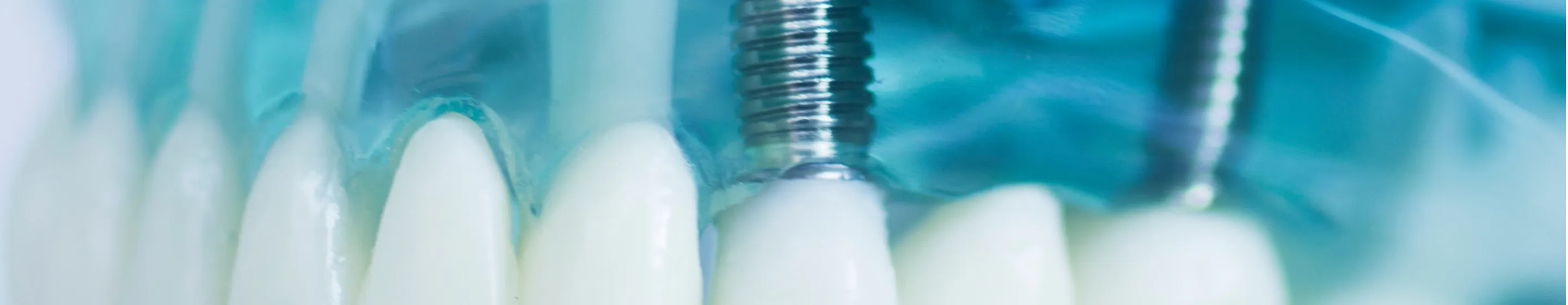 ファーストビュー