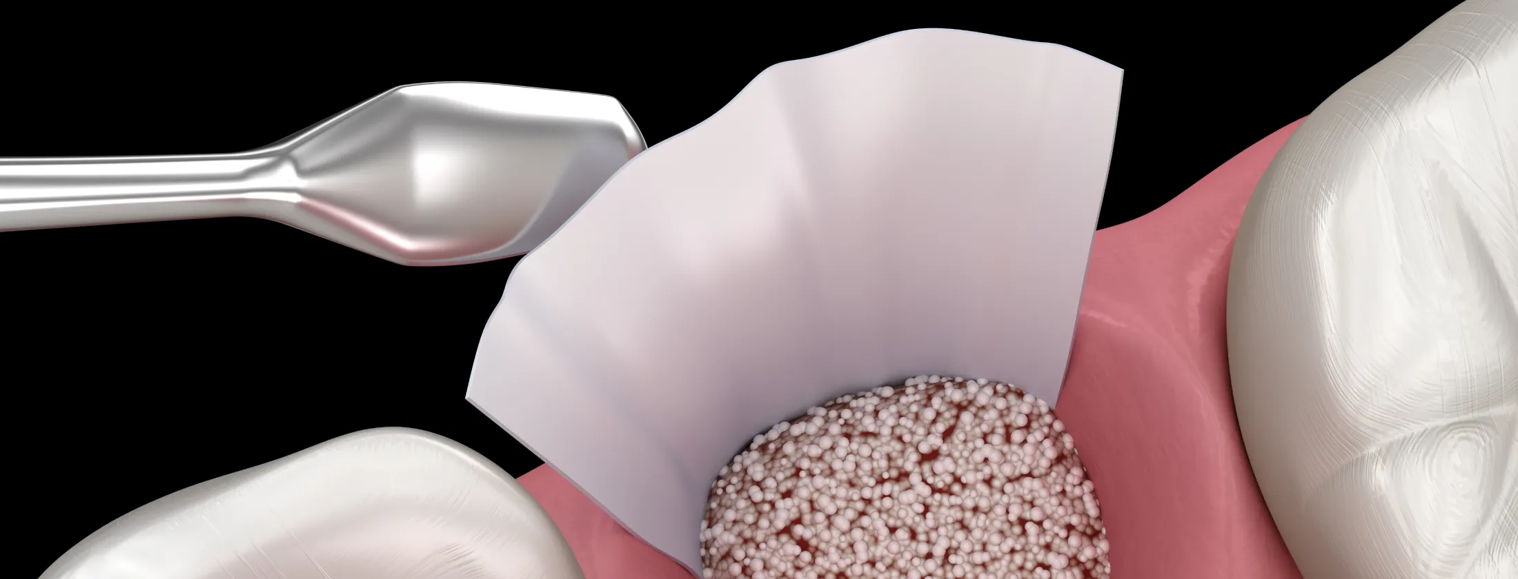 3.再生療法の治療方法 ― 科学的根拠に基づく“組織再生”のアプローチ