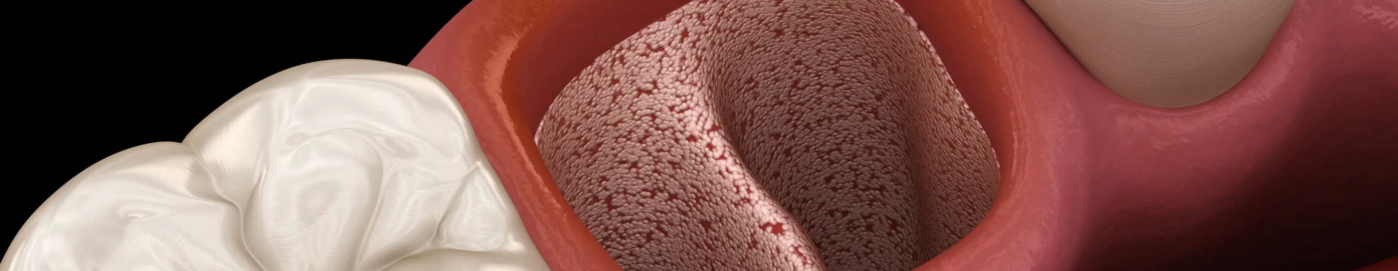 ファーストビュー