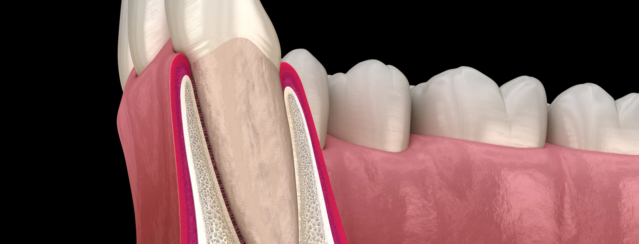 2.なぜ移植が可能なのか？ ― 歯と骨の“自然な結合”の仕組み
