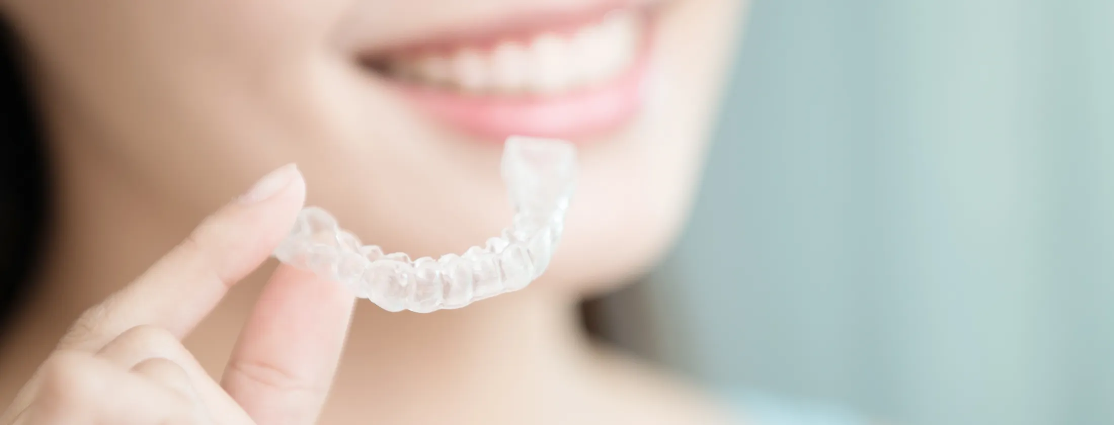 ②マウスピース矯正とは？― 目立ちにくく始められる大人の矯正治療