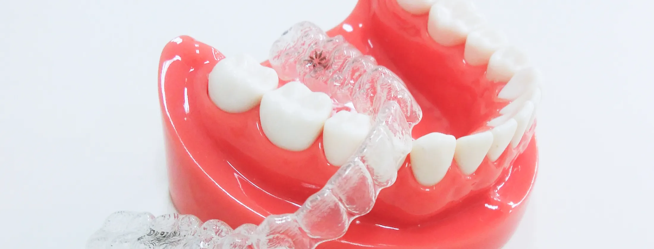 ③「歯並びが整えば終わり」ではない、矯正治療で本当に大切なこと