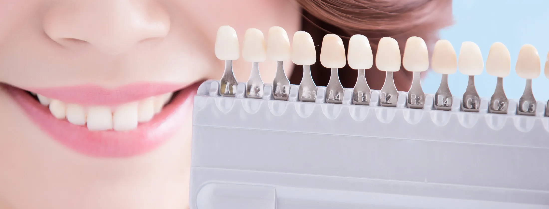 ①最近、歯の色が気になり始めたあなたへ