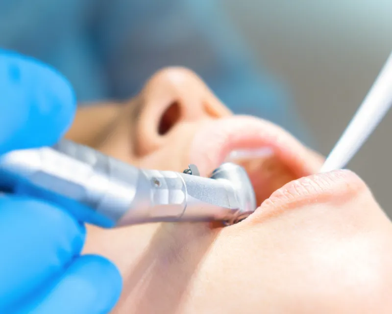 骨吸収が進行すると、治療の難易度は高まります