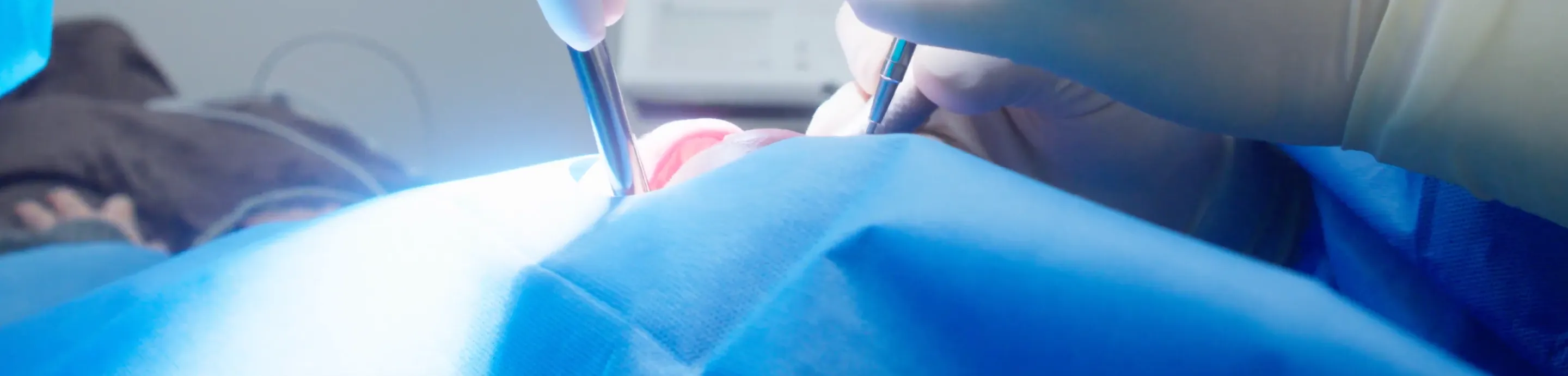 失われた歯周組織を生物学的に再構築する「再生療法」