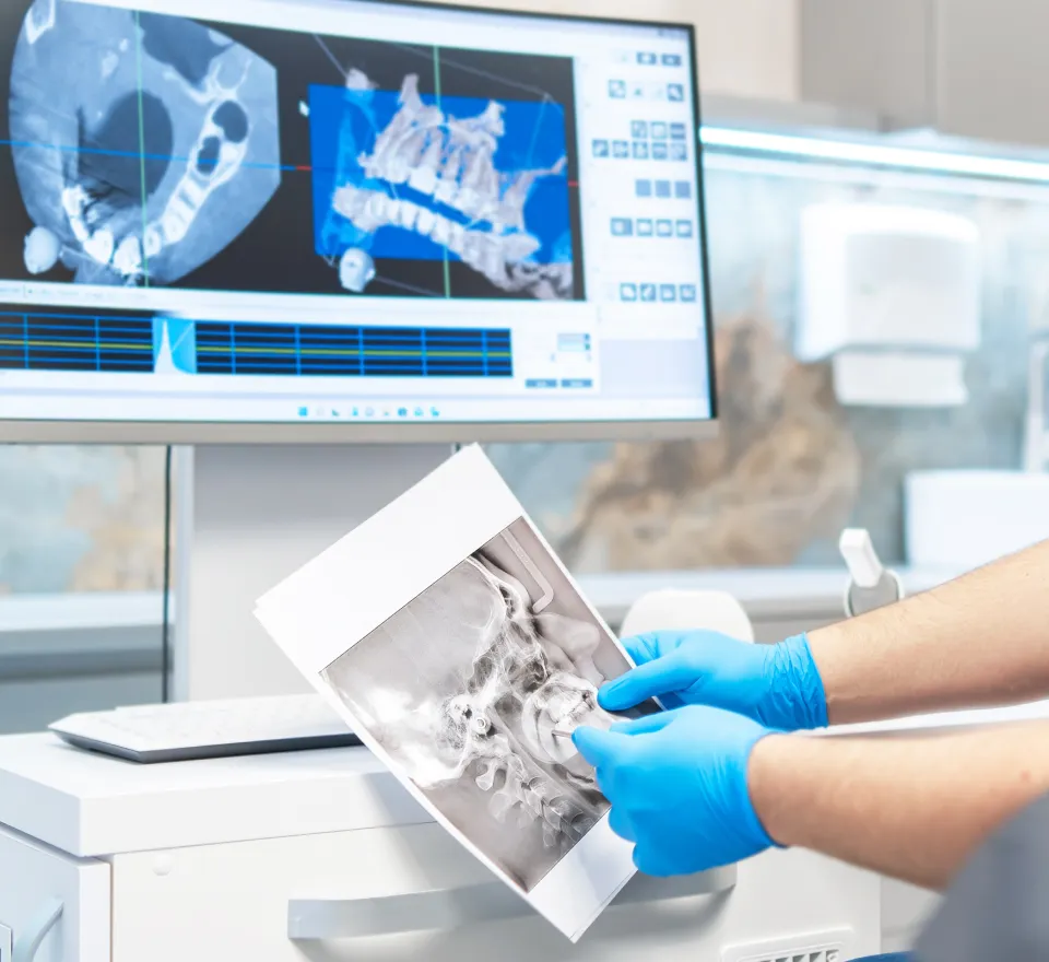 重度歯周病 難症例対応