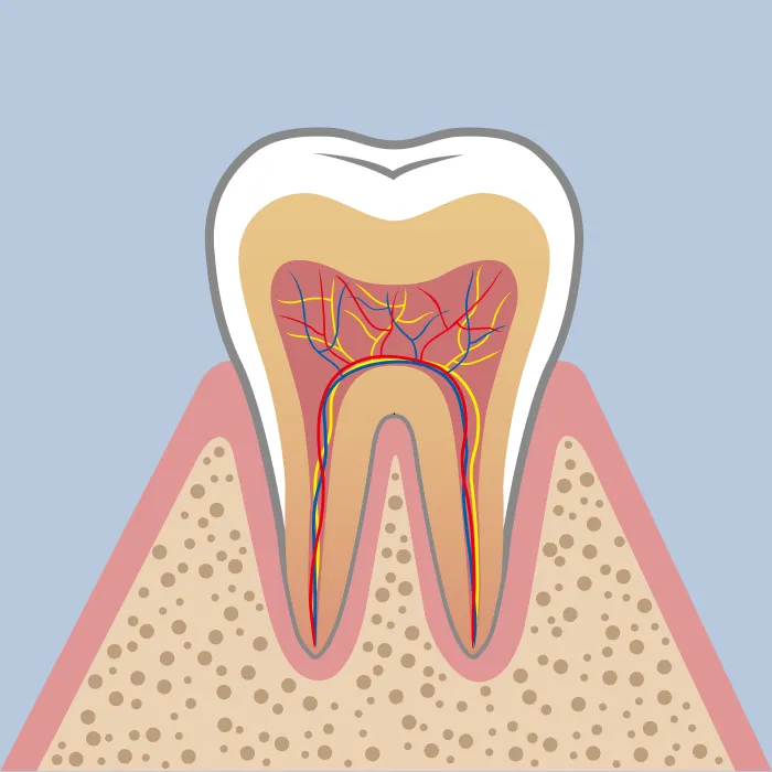 歯肉炎（Gingivitis）