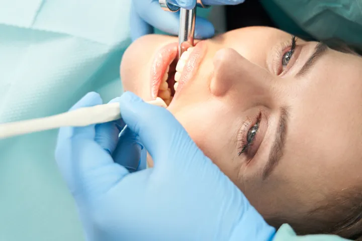 根管充填（MTAセメント等）