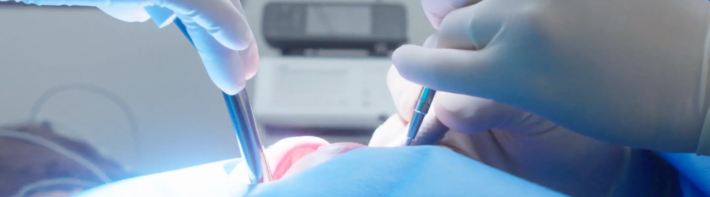 成功率を高める「精密根管治療」のメソッド