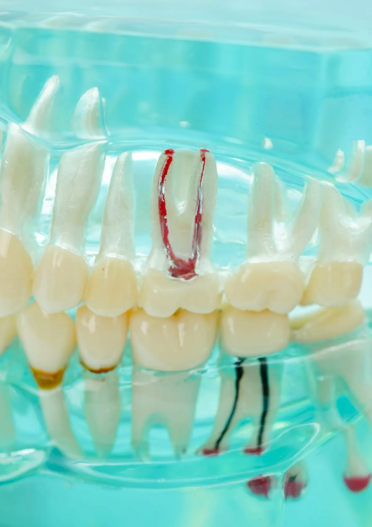 「暗闇の手探り」から「鮮明な可視化」へ。