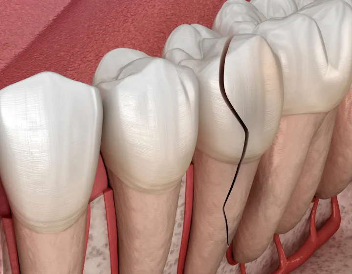 【医学的限界】 物理的に保存が不可能なケース