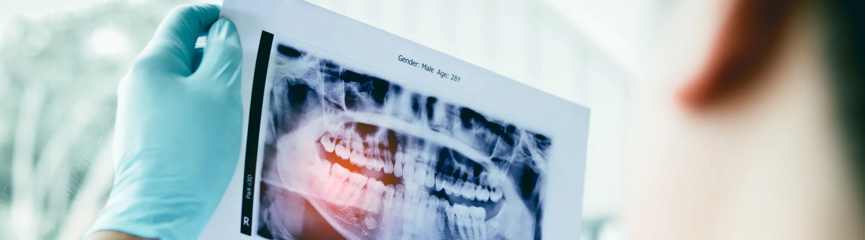 精密検査による「保存判定」