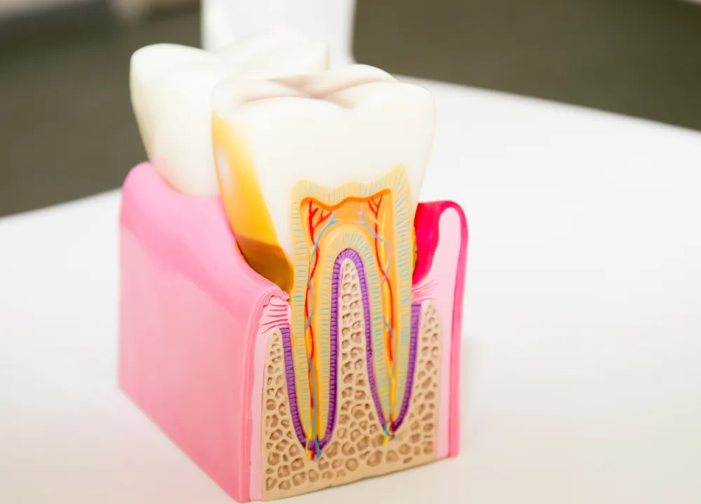 歯の寿命を決める「生命線」それが歯髄（神経）