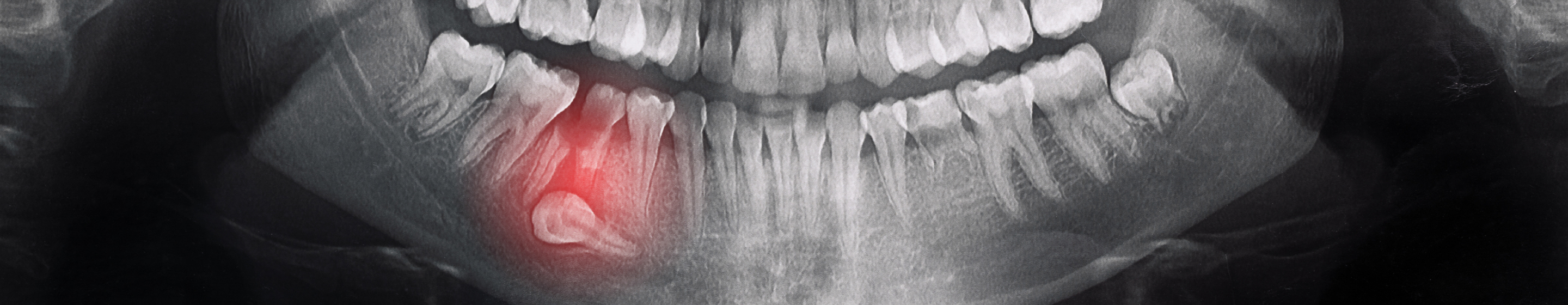 ファーストビュー