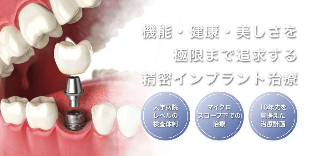 精密インプラント治療|LOTUS DENTAL CLINIC東京